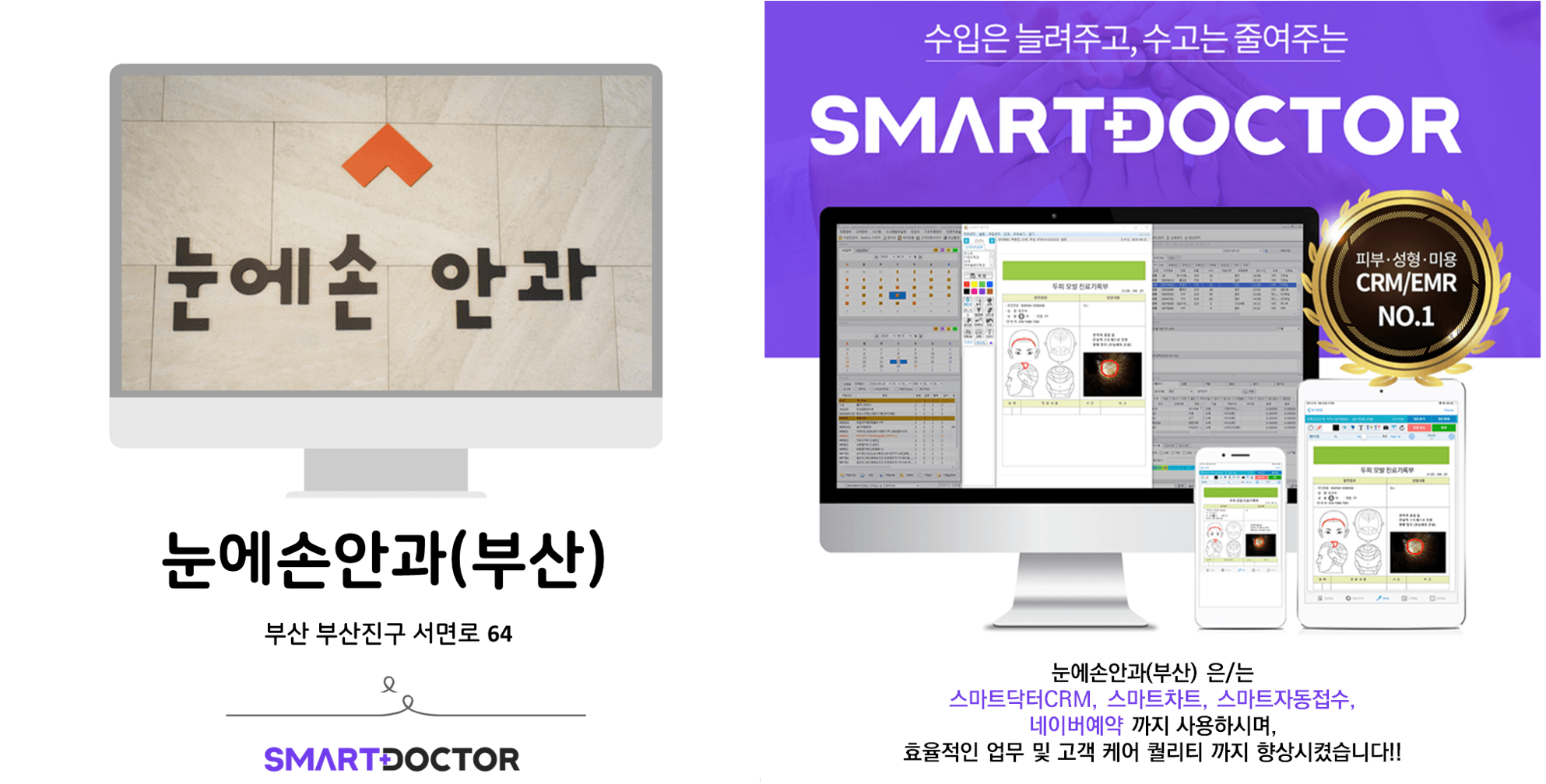 눈에손안과(부산)